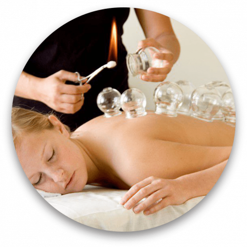 Cupping thérapie - ventouses / Source: https://www.pngegg.com